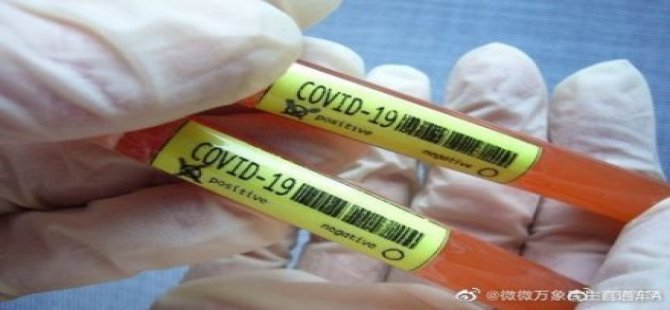 Çinli bilim insanları virüsü %96.5-99.9  emebilen bir nanomadde keşfettiklerni açıkladı