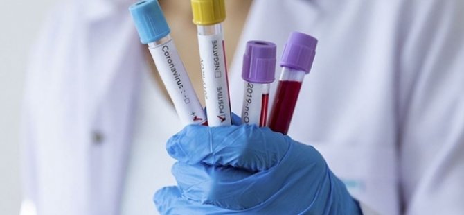 Rus bilim insanları koronavirüse yönelik yüksek hassasiyetli test geliştirdi