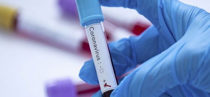 8 Örgüt:Koronavirüsün bulaştığı, önlemlerin aç bıraktığı bedenlerin ırkı, milleti yoktur