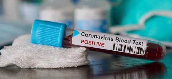 Koronavirüs testi yapan özel şirket sonuçları bildirmedi: 'Bu hareket vahim sonuçlar doğurdu'