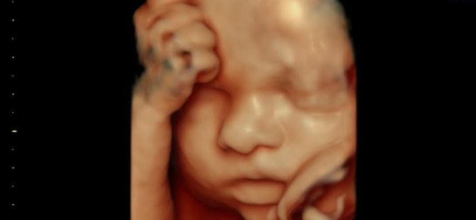 Anne Karnındaki Bebeğin Anatomik Yapısını Gerçeğe En Yakın Görüntü İle Veren Hd4d Ultrason Sistemi Yakın Doğu Üniversitesi Hastanesi’nde