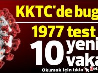 KKTC'de bugün 1977 test 10 pozitif vaka