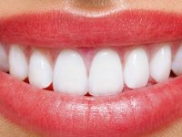 Dr. Efe Kaya; Daha Beyaz Dişlere Sahip Olabilirsiniz !