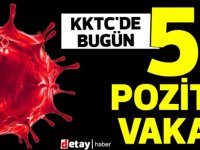 KKTC'de bugün 5 pozitif vaka!