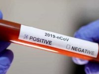 Pfizer Aşısı Olan Doktor Koronavirüse Yakalandı: Pozitif Çıktım Ama Tekrar Aşı Olurum Dedi