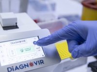 Türk Bilim İnsanları Koronavirüs Teşhisini 10 Saniyeye Düşüren Tanı Sistemi Geliştirdi