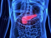 Uzmanlar pankreas kanserinin en büyük nedeni açıkladı!