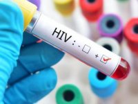 “Kıbrıs’ta HIV Salgın Analiz Raporu” Bakan Fikri Ataoğlu’na Sunuldu