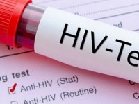 26 bin kişi HIV pozitif