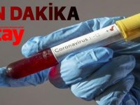 Güney Kıbrıs’ta 5 Yeni Koronavirüs Vakası
