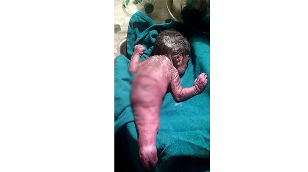 deniz-kizi-bedeniyle-dunya-geldi-6972814.jpeg deniz-kizi-bedeniyle-dunya-geldi-6972814.jpeg