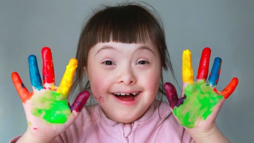 Tarih yazan sekiz Down Sendromlu galerisi resim 1