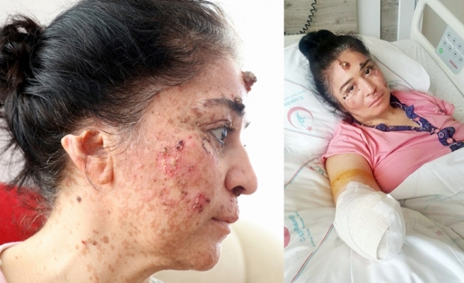 Güneşe çıktıkça eriyor. Hastalığını araştırıyorlar galerisi resim 10