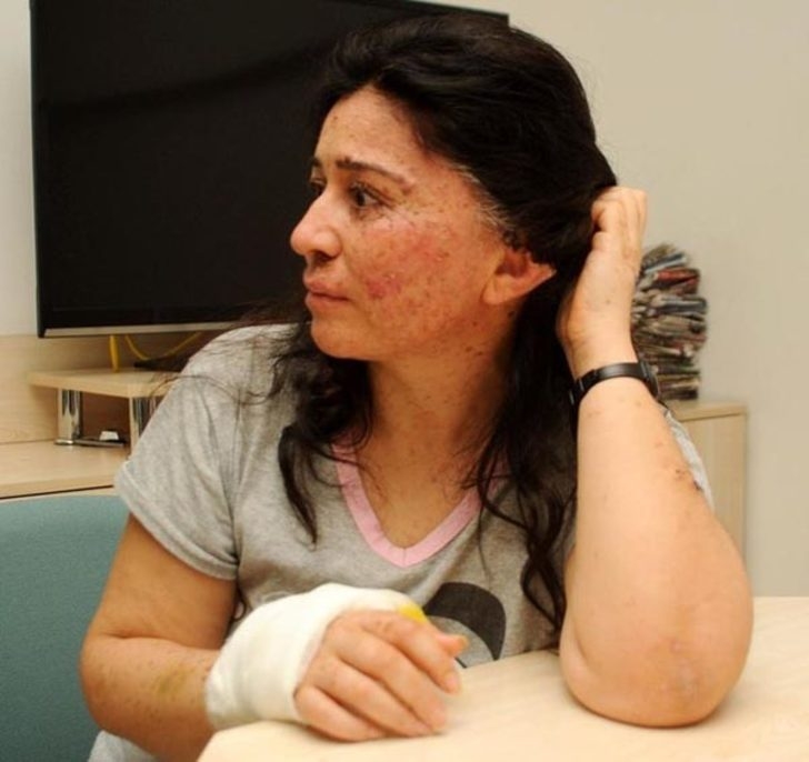 Güneşe çıktıkça eriyor. Hastalığını araştırıyorlar galerisi resim 4