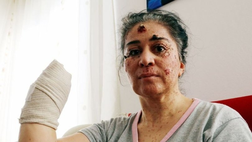 Güneşe çıktıkça eriyor. Hastalığını araştırıyorlar galerisi resim 5