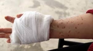 Güneşe çıktıkça eriyor. Hastalığını araştırıyorlar galerisi resim 6