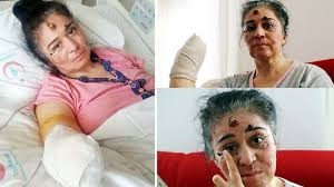 Güneşe çıktıkça eriyor. Hastalığını araştırıyorlar galerisi resim 8