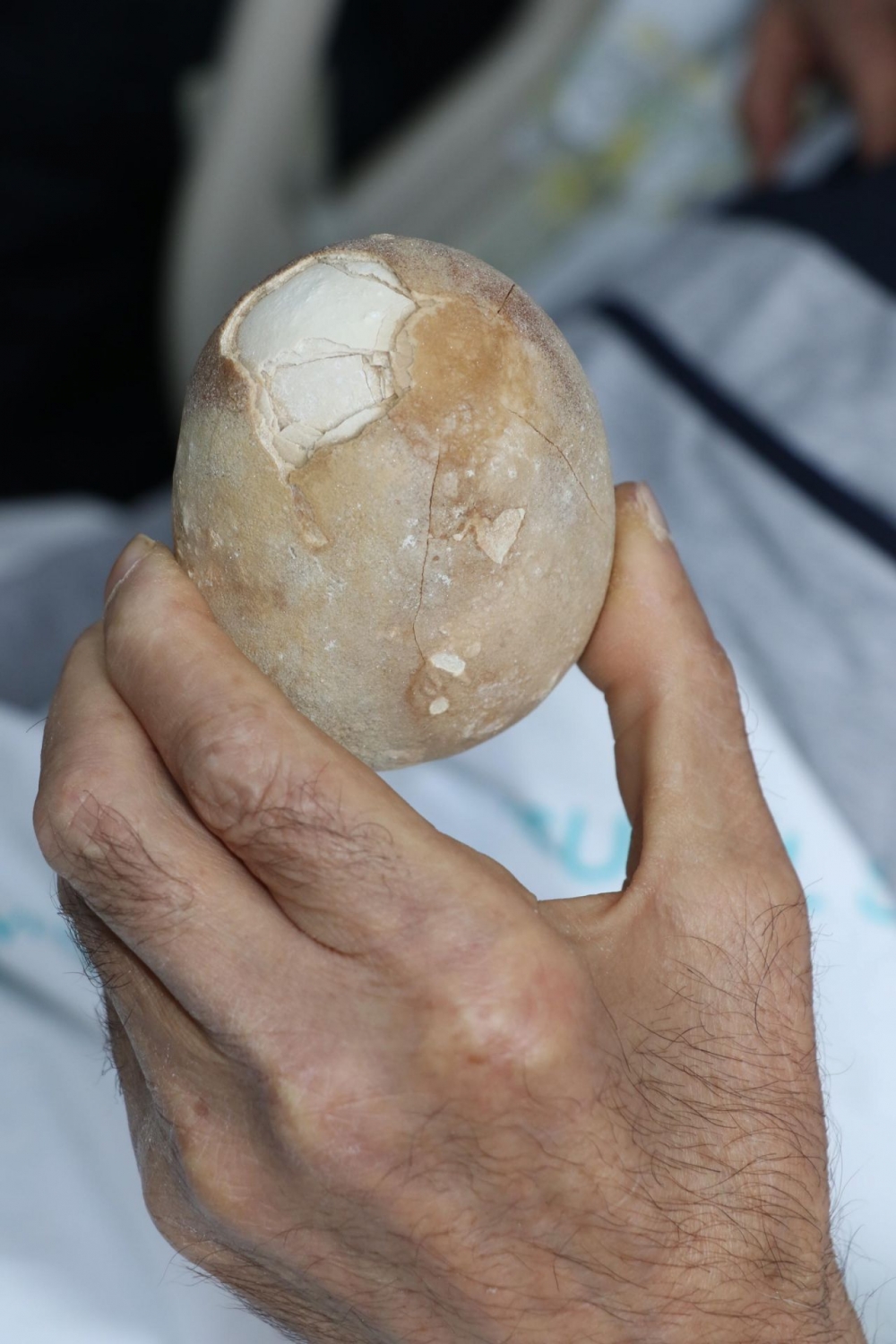 Patates sandılar.Hastanın karnından çıkınca doktor da şaşkına döndü galerisi resim 4