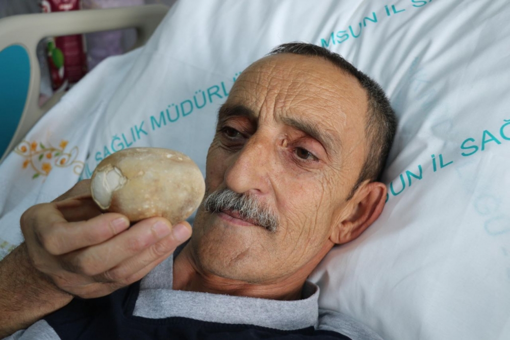 Patates sandılar.Hastanın karnından çıkınca doktor da şaşkına döndü galerisi resim 8