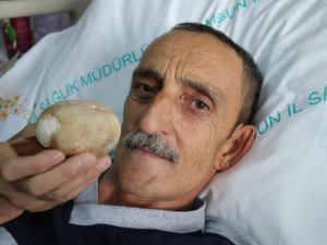 Patates sandılar.Hastanın karnından çıkınca doktor da şaşkına döndü