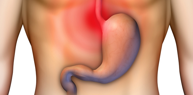 Reflü şikayetlerini azaltmanın 10 altın kuralı galerisi resim 4