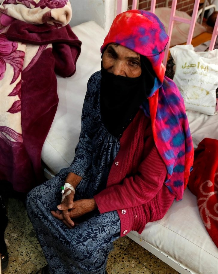 Korkunç kareler! Kolera salgını en az 190 can aldı galerisi resim 1