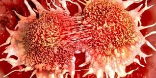 Önlem alarak önüne geçmek mümkün! Kanser riskini azaltmanın 8 yolu galerisi resim 2