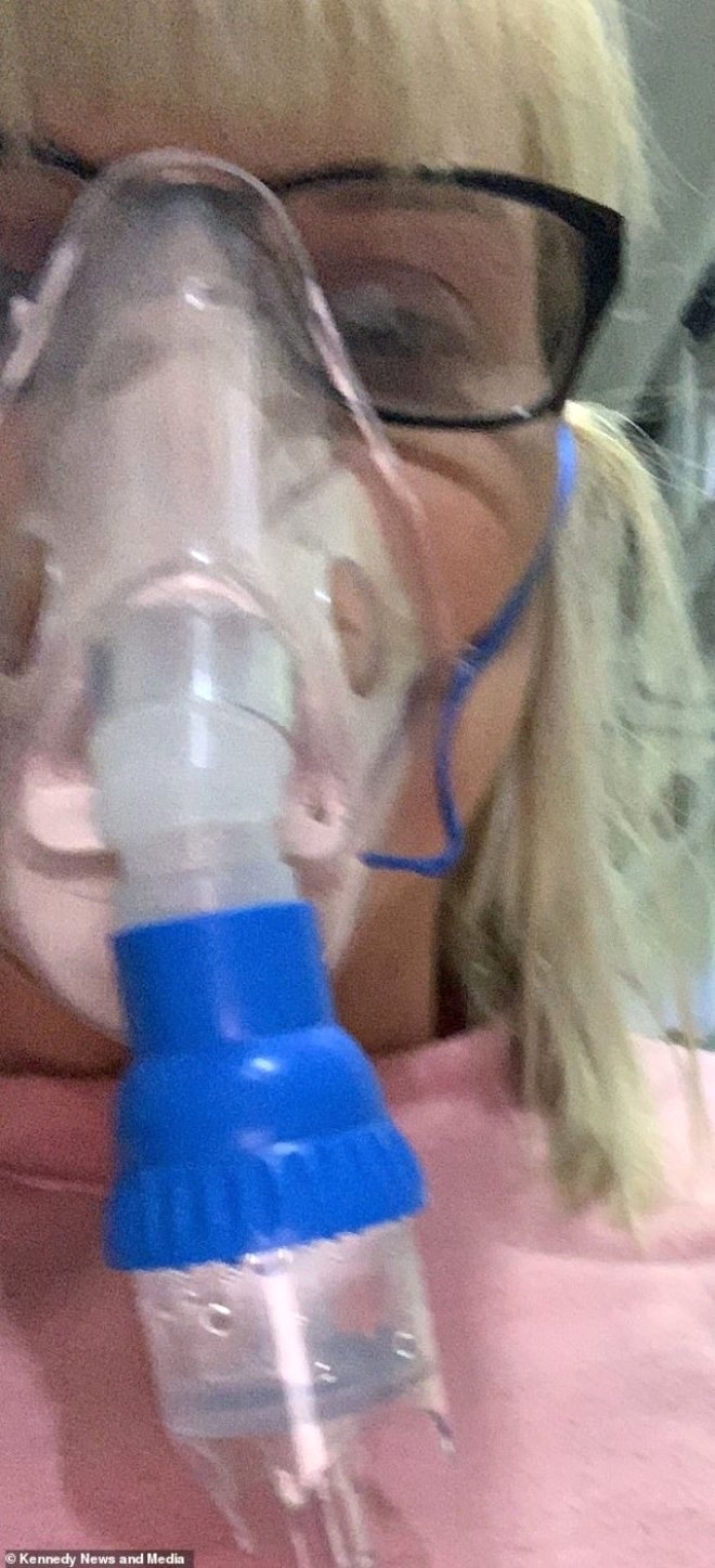 Dudaklarına dolgu yaptırmak istemişti, ölümle burun buruna geldi! galerisi resim 8