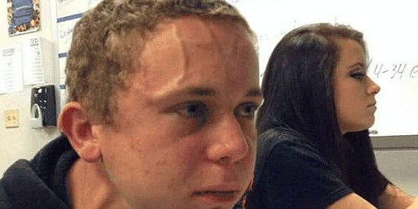 Gaz çıkarma tam olarak nedir? Fazla gaz çıkarmak hastalık habercisi midi galerisi resim 10