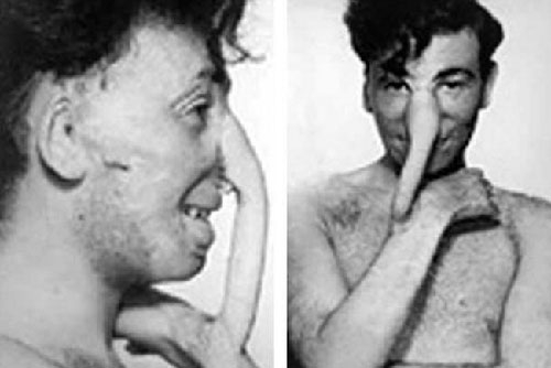 Geçmişte Kullanılan İnanılmaz Tehlikeli Tedavi Yöntemleri galerisi resim 8