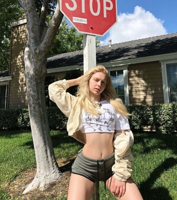 Aleyna Tilki'den estetik açıklaması! Kalçasına yağ enjekte ettirdiğ galerisi resim 11