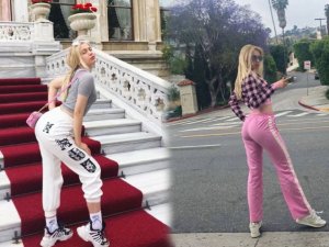 Aleyna Tilki'den estetik açıklaması! Kalçasına yağ enjekte ettirdiğ