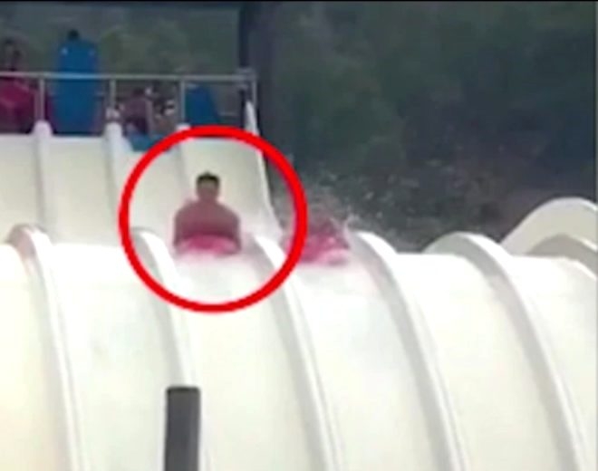 Su kaydırağından kayarken cinsel organı parçalandı! galerisi resim 8