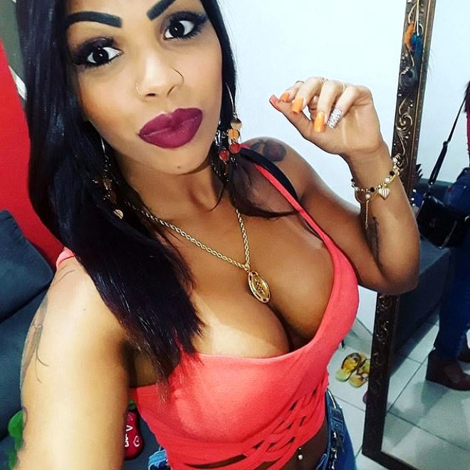 Kalça kaldırma operasyonu yüzünden canından oluyordu! galerisi resim 1