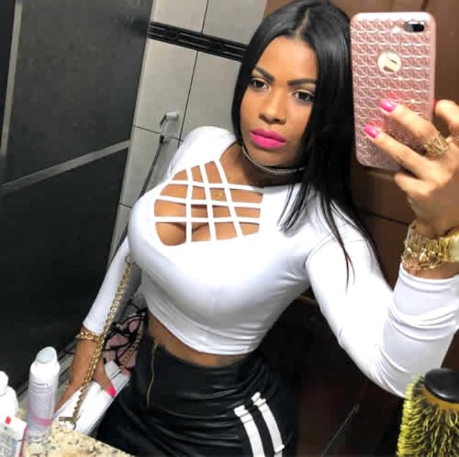 Kalça kaldırma operasyonu yüzünden canından oluyordu! galerisi resim 3