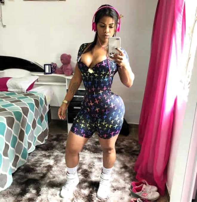 Kalça kaldırma operasyonu yüzünden canından oluyordu! galerisi resim 4