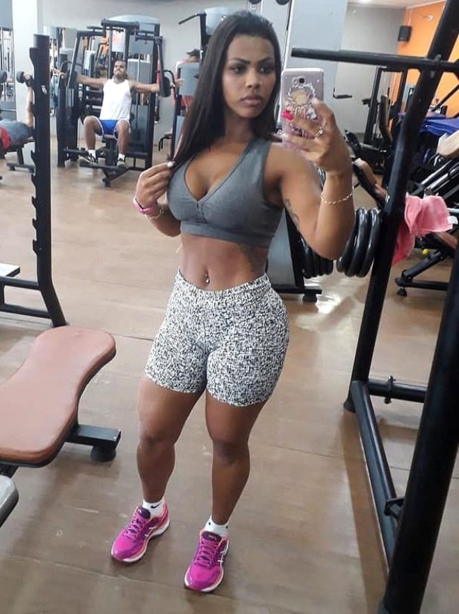 Kalça kaldırma operasyonu yüzünden canından oluyordu! galerisi resim 5