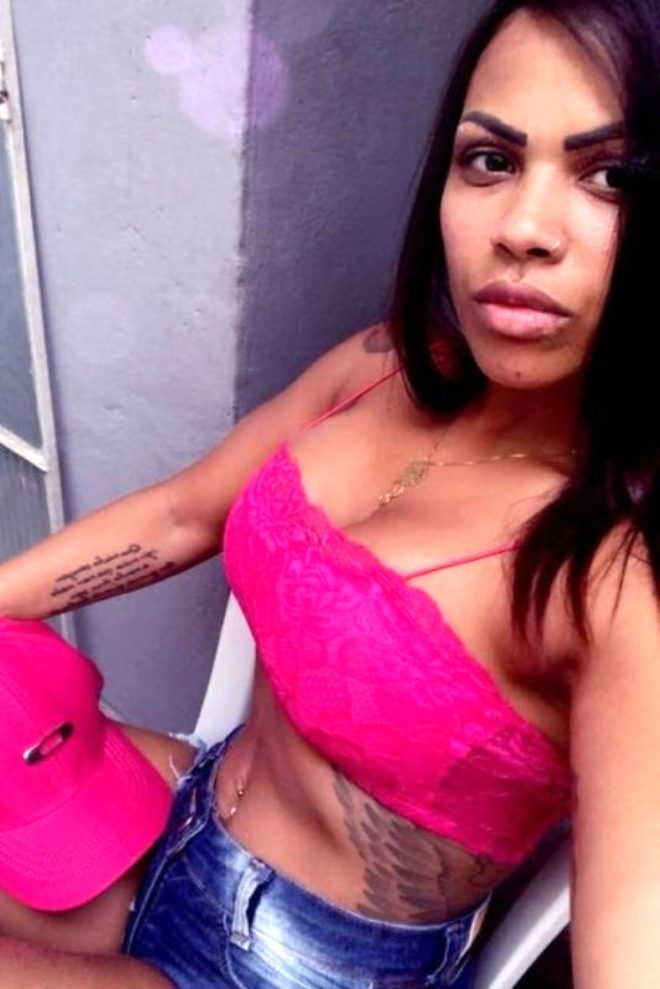 Kalça kaldırma operasyonu yüzünden canından oluyordu! galerisi resim 6