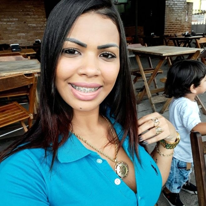 Kalça kaldırma operasyonu yüzünden canından oluyordu! galerisi resim 8