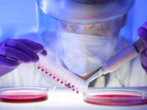 Cinsel ilişkiye girdiğiniz kişiye dikkat! AIDS Türkiye'de patlama y