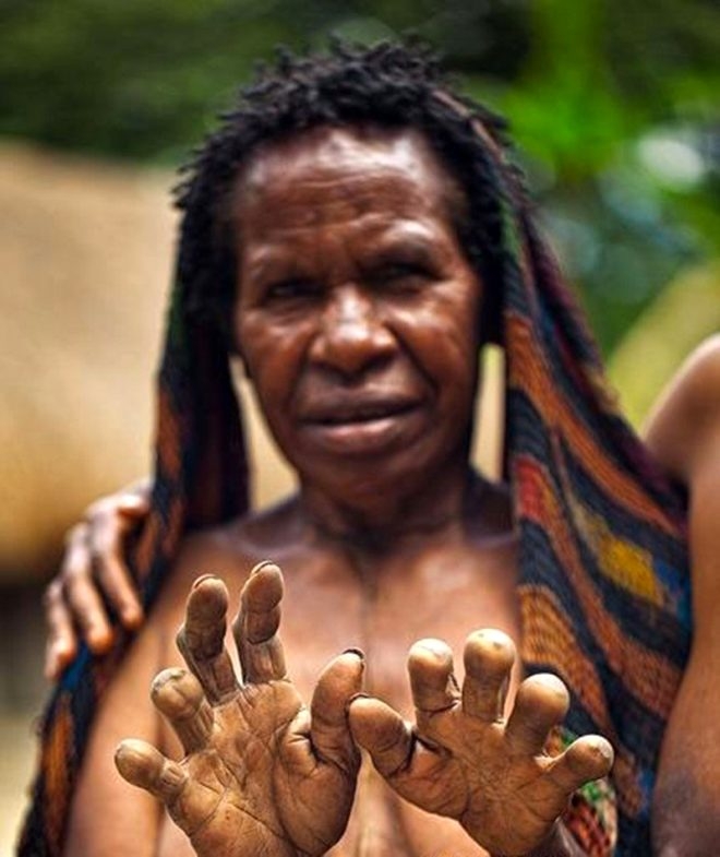 Sevdiği biri ölünce parmaklarını kesiyorlar galerisi resim 1