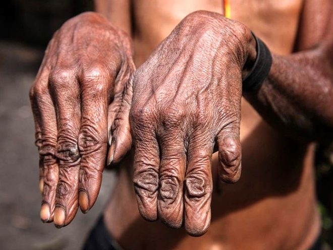 Sevdiği biri ölünce parmaklarını kesiyorlar galerisi resim 5