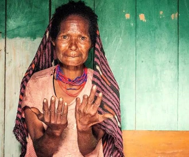 Sevdiği biri ölünce parmaklarını kesiyorlar galerisi resim 6