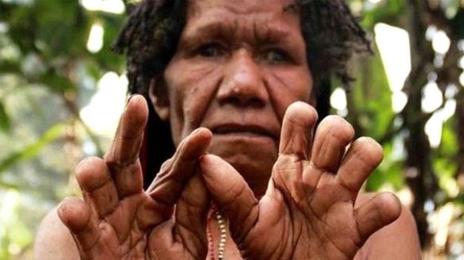 Sevdiği biri ölünce parmaklarını kesiyorlar galerisi resim 7