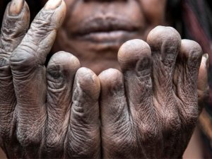 Sevdiği biri ölünce parmaklarını kesiyorlar