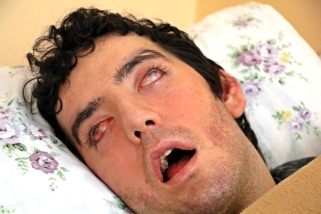 6 yıldır gözlerini kapatamıyor! galerisi resim 1