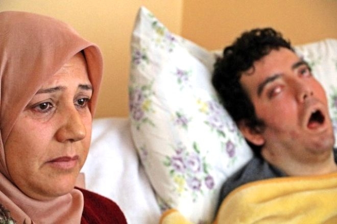 6 yıldır gözlerini kapatamıyor! galerisi resim 2