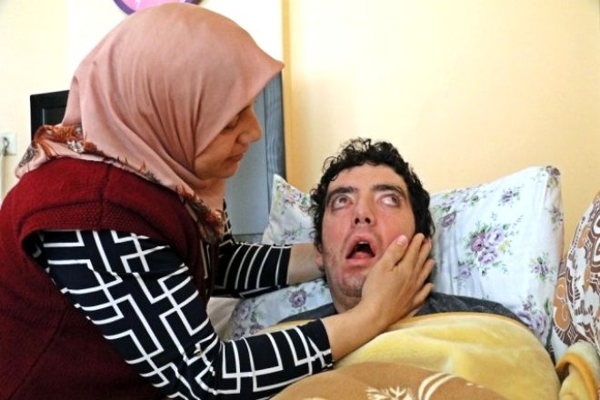 6 yıldır gözlerini kapatamıyor! galerisi resim 3