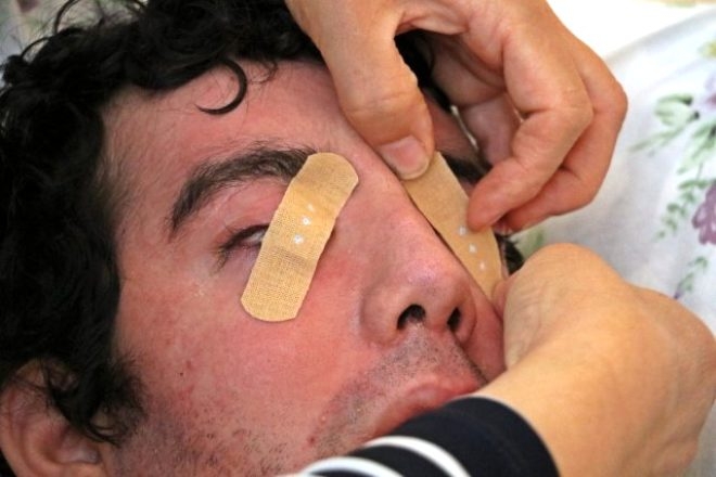 6 yıldır gözlerini kapatamıyor! galerisi resim 4