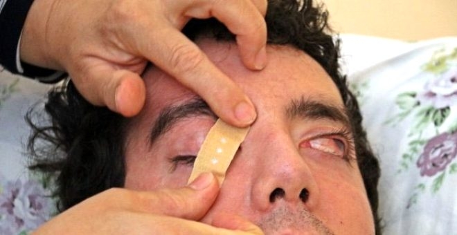 6 yıldır gözlerini kapatamıyor! galerisi resim 6